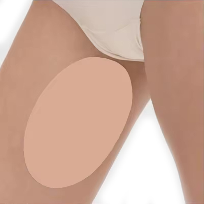 AntiChafing, self-adhesive protection to prevent chafing between the thighs (2 pieces)
