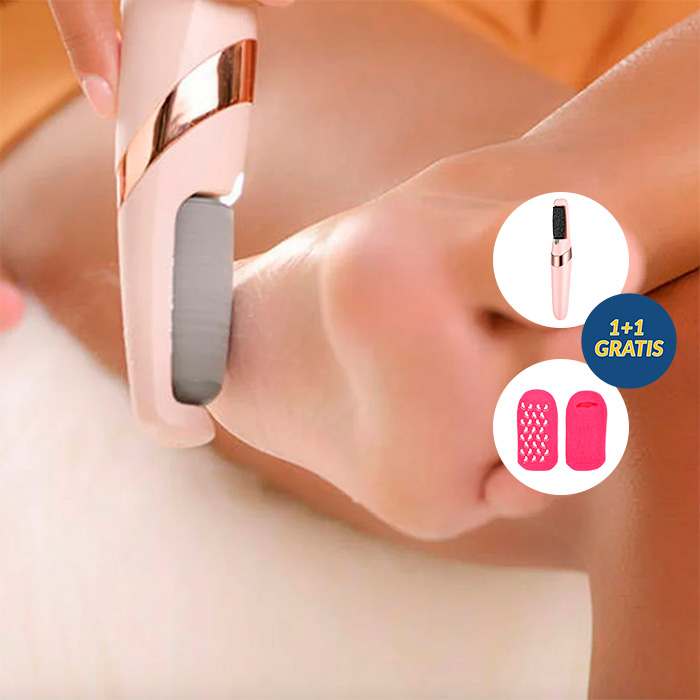 FeetBundle, electric hard skin remove roller + socks for dry and cracked feet FREE - Image 2