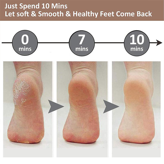 FootFile, the ultimate handheld pedicure file - Image 5