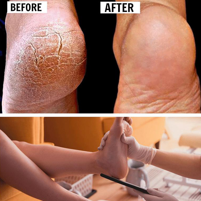 FootFile, the ultimate handheld pedicure file - Image 7