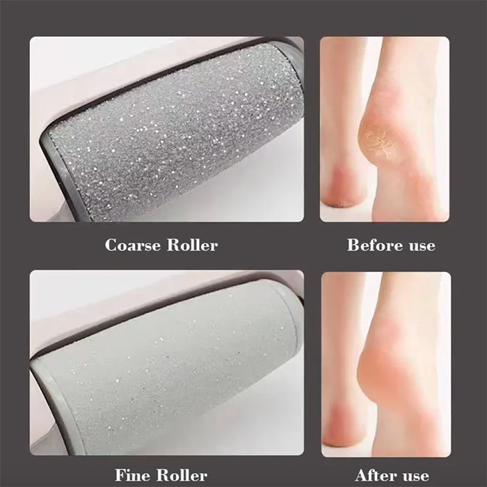Heely, the electric roller for removing hard skin on heels - Image 7