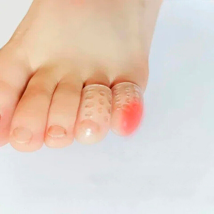 ToeProtector, silicone toe protector (10 pieces) - Image 8