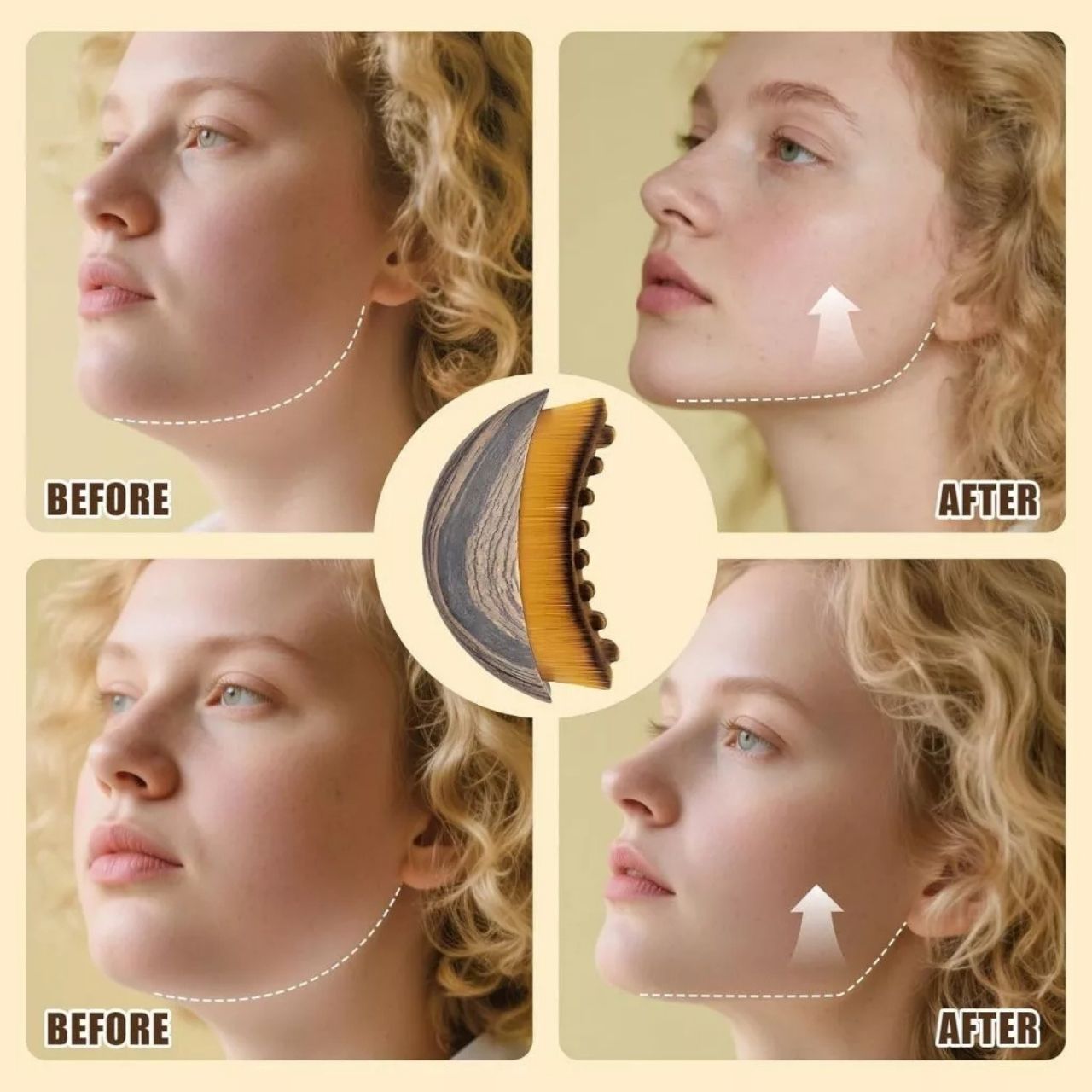 Precise fit to facial lines