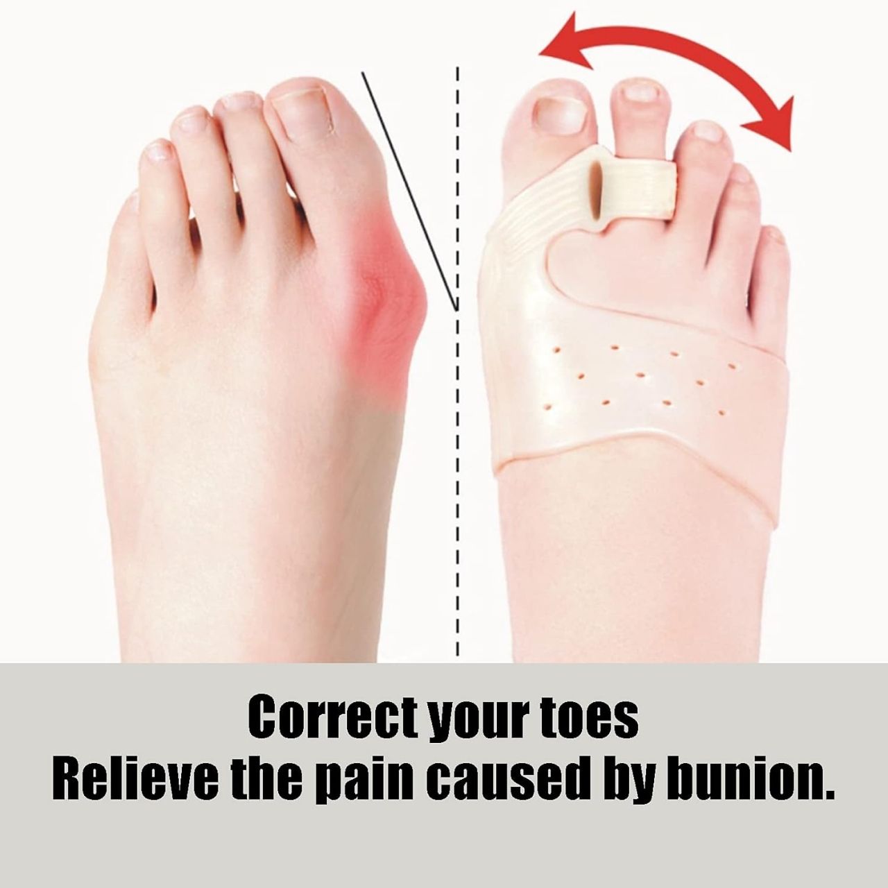 ToeCorrect, a brace for toe correction - Image 4