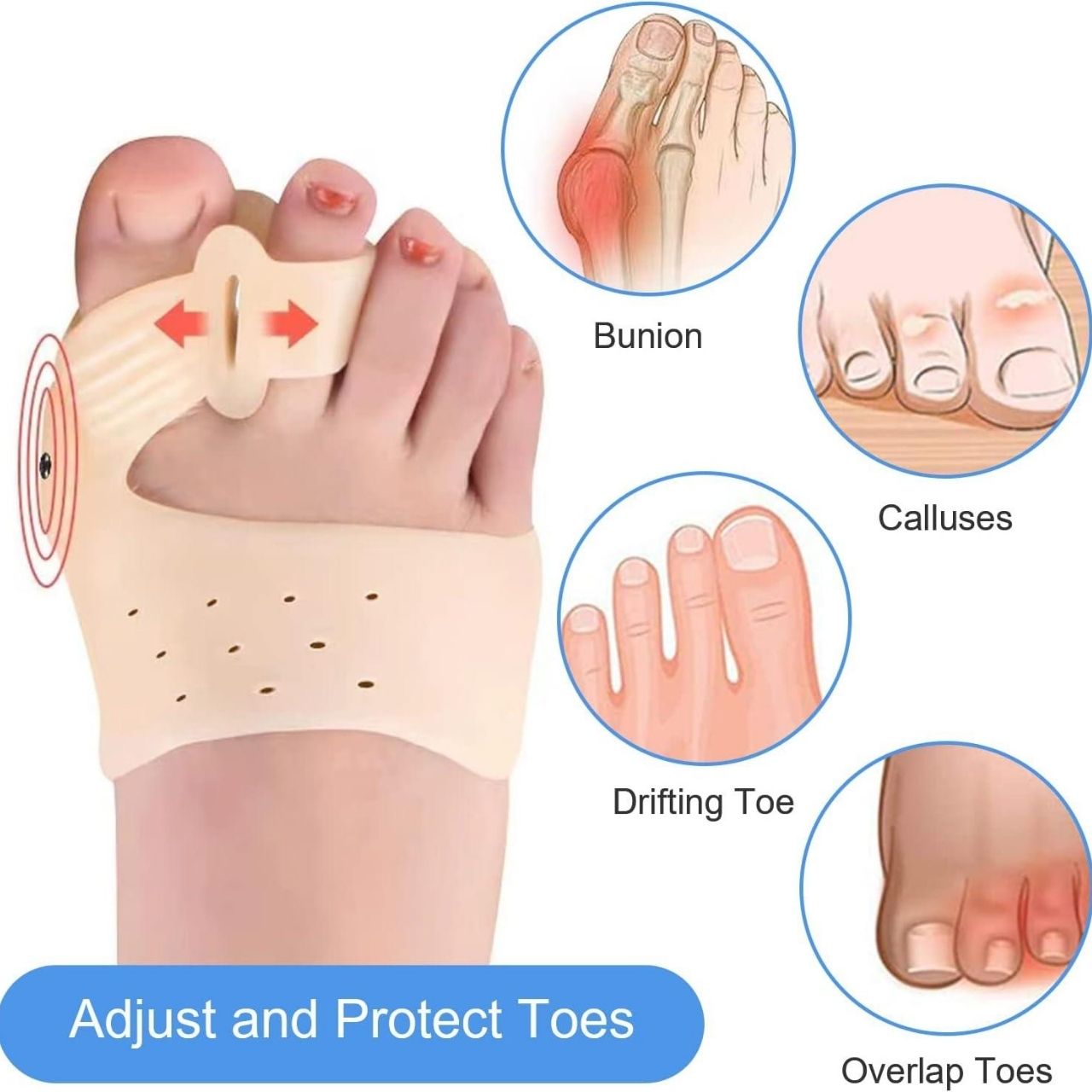 ToeCorrect, a brace for toe correction - Image 2